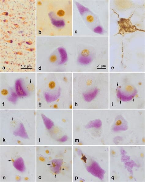 cells of betz